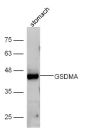 Anti-GSDMA antibody used in Western Blot (WB). GTX03715