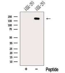 Anti-NCOA6 antibody used in Western Blot (WB). GTX03716