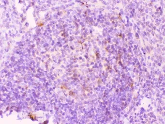 Anti-MMP11 antibody used in IHC (Paraffin sections) (IHC-P). GTX03717