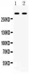 Anti-Versican antibody used in Western Blot (WB). GTX03733