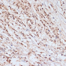 Anti-BRCA1 (phospho Ser1423) antibody used in IHC (Paraffin sections) (IHC-P). GTX03784