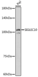 Anti-SIGLEC10 antibody used in Western Blot (WB). GTX03786