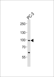 Anti-SCAP antibody used in Western Blot (WB). GTX03796