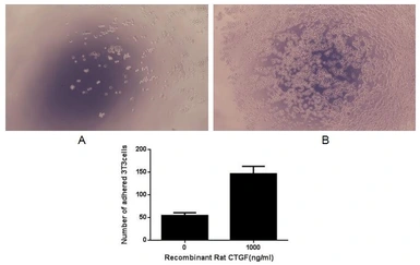 Rat CTGF protein, His and GST tag (active). GTX03797-pro