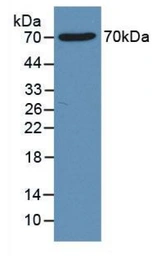 Rat CTGF protein, His and GST tag (active). GTX03797-pro