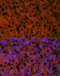 Anti-PLGF antibody [GT1358] used in IHC (Paraffin sections) (IHC-P). GTX03799