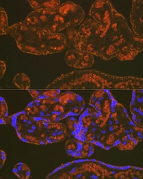 Anti-PLGF antibody [GT1358] used in IHC (Paraffin sections) (IHC-P). GTX03799