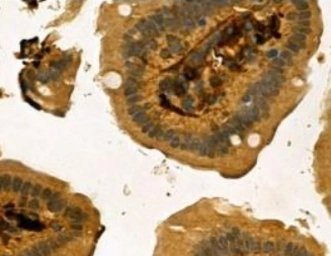 Anti-CA125 antibody used in IHC (Paraffin sections) (IHC-P). GTX03800