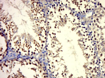 Anti-Androgen Receptor antibody used in IHC (Paraffin sections) (IHC-P). GTX03929