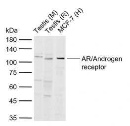 Anti-Androgen Receptor antibody used in Western Blot (WB). GTX03929