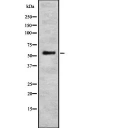 Anti-DMP1 antibody used in Western Blot (WB). GTX04077