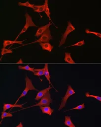 Anti-PI3 kinase p110 gamma antibody used in Immunocytochemistry/ Immunofluorescence (ICC/IF). GTX04094