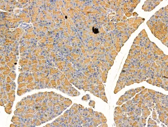 Anti-ARC antibody used in IHC (Paraffin sections) (IHC-P). GTX04096
