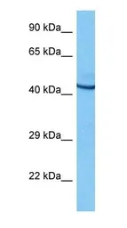 Anti-POU2F3 antibody used in Western Blot (WB). GTX04103