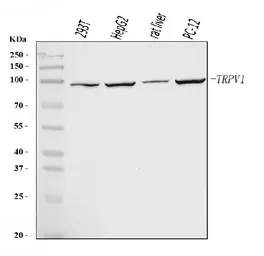 Anti-VR1/ TRPV1 antibody used in Western Blot (WB). GTX04108