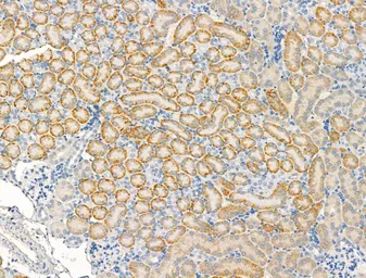 Anti-Trek1 antibody used in IHC (Paraffin sections) (IHC-P). GTX04112