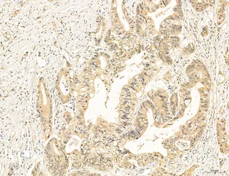 Anti-CCR2 antibody used in IHC (Paraffin sections) (IHC-P). GTX04115