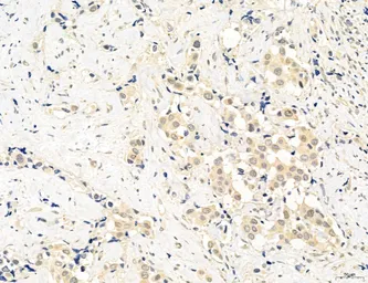 Anti-CCR2 antibody used in IHC (Paraffin sections) (IHC-P). GTX04115