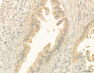Anti-CCR2 antibody used in IHC (Paraffin sections) (IHC-P). GTX04115
