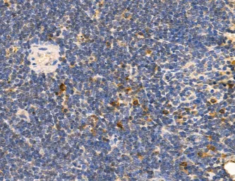 Anti-CCR2 antibody used in IHC (Paraffin sections) (IHC-P). GTX04115