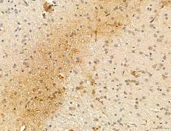 Anti-CCR2 antibody used in IHC (Paraffin sections) (IHC-P). GTX04115