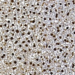 Anti-GLI3 antibody used in IHC (Paraffin sections) (IHC-P). GTX04242