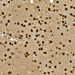 Anti-GLI3 antibody used in IHC (Paraffin sections) (IHC-P). GTX04242