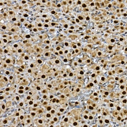 Anti-GLI3 antibody used in IHC (Paraffin sections) (IHC-P). GTX04242