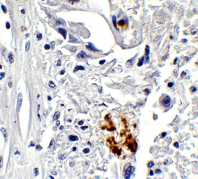 Anti-NCOA4 antibody used in IHC (Paraffin sections) (IHC-P). GTX04250