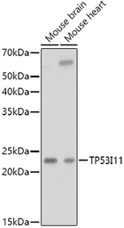 Anti-TP53I11 antibody used in Western Blot (WB). GTX04308