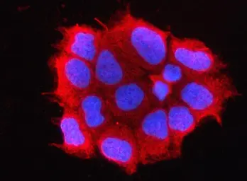 Anti-OMP antibody used in Immunocytochemistry/ Immunofluorescence (ICC/IF). GTX04312