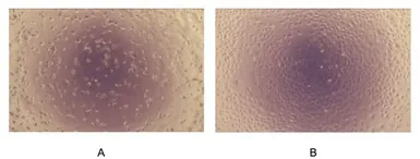 Mouse TGF beta 1 protein, His tag (active). GTX04319-pro