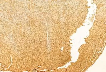 Anti-mTOR antibody used in IHC (Paraffin sections) (IHC-P). GTX04334