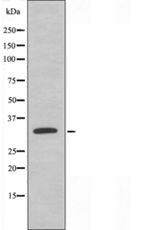 Anti-ACER2 antibody used in Western Blot (WB). GTX04335