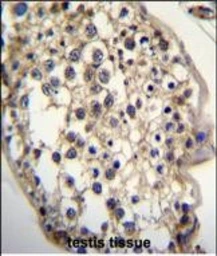 Anti-DHCR7 antibody used in IHC (Paraffin sections) (IHC-P). GTX04343
