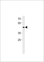 Anti-SHARP1 antibody used in Western Blot (WB). GTX04346