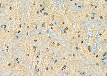 Anti-SHARP1 antibody used in IHC (Paraffin sections) (IHC-P). GTX04347