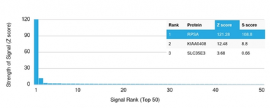 Anti-RPSA antibody [RPSA/2699] used in Protein Array (Protein Array). GTX04349