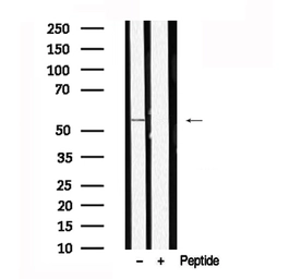 Anti-PAX7 antibody used in Western Blot (WB). GTX04358