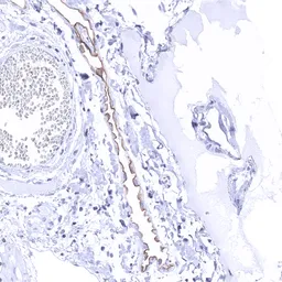 Anti-UPK3B antibody [MSVA-736M] HistoMAX&trade; used in IHC (Paraffin sections) (IHC-P). GTX04476