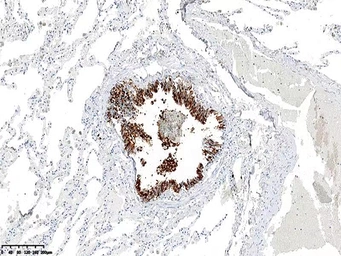 Anti-ALOX15 antibody [OTI3G8] used in IHC (Paraffin sections) (IHC-P). GTX04520