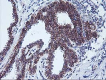 Anti-ALOX15 antibody [OTI3G8] used in IHC (Paraffin sections) (IHC-P). GTX04520