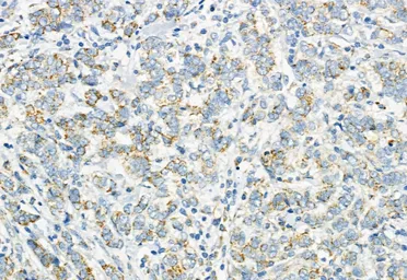 Anti-LGR5 antibody used in IHC (Paraffin sections) (IHC-P). GTX04555