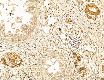Anti-TIP47 antibody used in IHC (Paraffin sections) (IHC-P). GTX04559