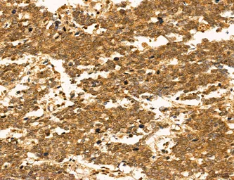 Anti-TIP47 antibody used in IHC (Paraffin sections) (IHC-P). GTX04559