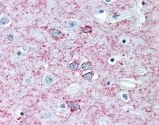 Anti-Adenosine A2a Receptor antibody [7F6-G5-A2] used in IHC (Paraffin sections) (IHC-P). GTX04561