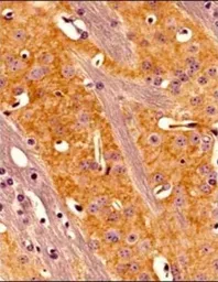 Anti-Adenosine A2a Receptor antibody [7F6-G5-A2] used in IHC (Paraffin sections) (IHC-P). GTX04561