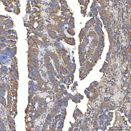 Anti-SLC20A1 antibody used in IHC (Paraffin sections) (IHC-P). GTX04583