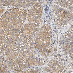 Anti-SLC20A1 antibody used in IHC (Paraffin sections) (IHC-P). GTX04583