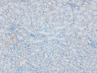 Anti-PKC beta 1 (phospho Ser661) antibody used in IHC (Paraffin sections) (IHC-P). GTX04593